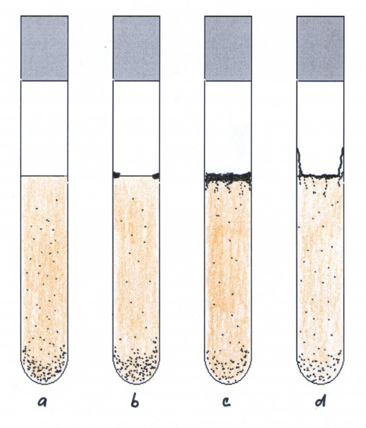 48. Charakter růstu v tekutých živných půdách: a) zákal a usazenina, b) usazenina a prstenec, c) usazenina a hrubá kožka, d) usazenina a tenká, zvrásněná, po stěnách zkumavky rostoucí kožka