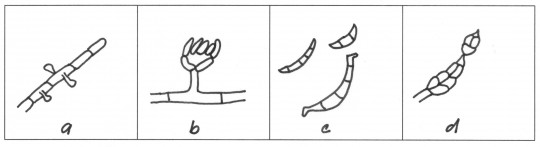 67. Tvar a umístění exospor: a) jednotlivé spory na přehrádkovaném myceliu, b) nepravá palička spor, c) rohlíčkovité makrokonidie, d) příčně i podélně septované makrokonidie