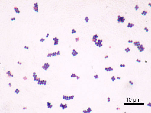 10. Staphylococcus aureus, Gram [31]