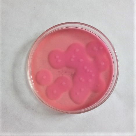 11. Bacillus cereus na živné půdě MYP