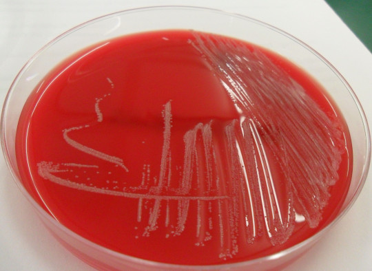 14. Corynebacterium diphtheriae [33]