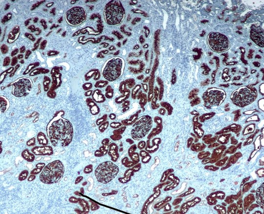 2. Staining of a kidney.