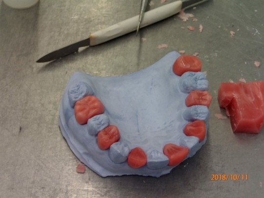 9. Modelled wax teeth set in a plaster model