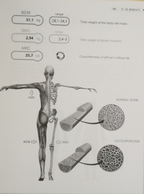 5. Comparison of results