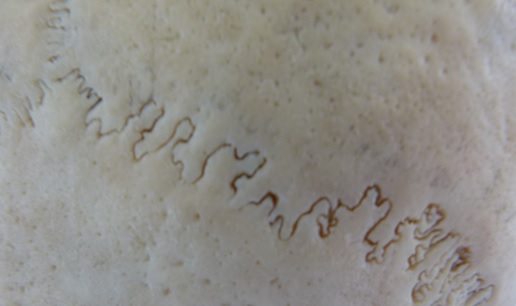 22. Lebeční švy – detail