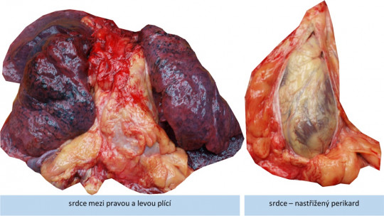 44. Pohled na srdce mezi plícemi, nastřižený perikard 