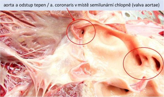 63. Odstup cév z počátečního úseku aorty – detail