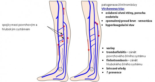 65. Patogeneze žilní trombózy