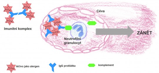 8. Reakce imunitních komplexů