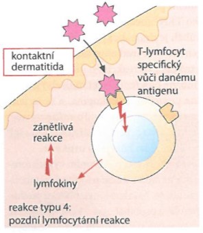 9. Reakce pozdní přecitlivělosti