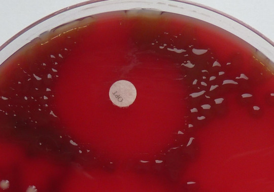 13. Optochinový test – Streptococcus pneumoniae